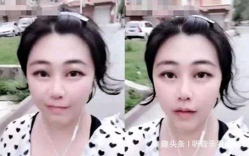 娱乐吃瓜酱鼻梁变高